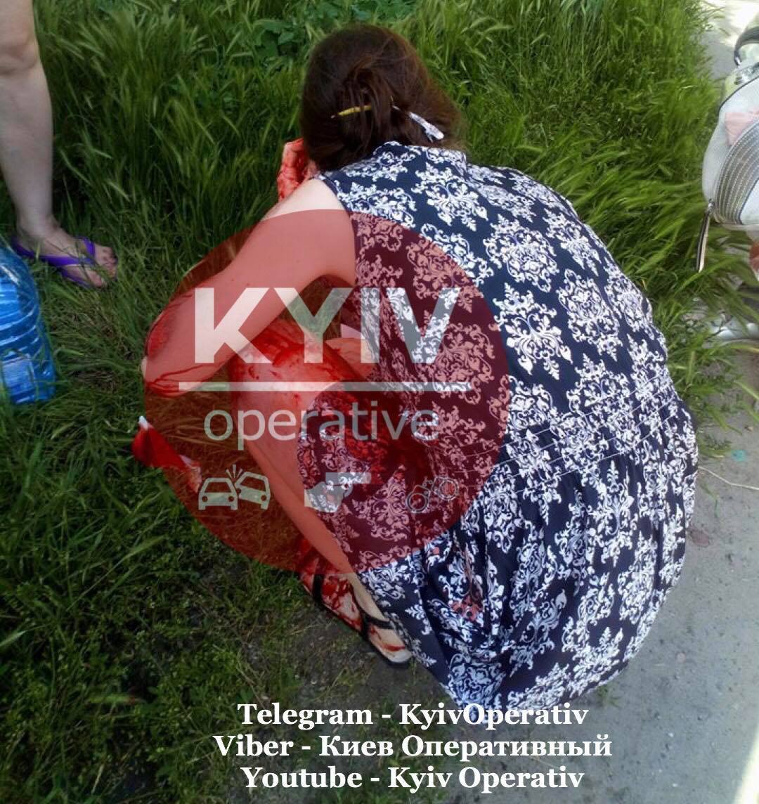 В Киеве авто на переходе сбило женщину и скрылось