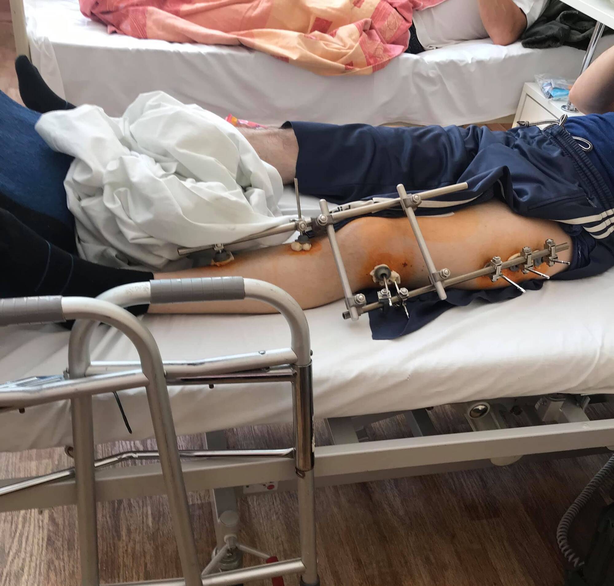 Поранений боєць із Донбасу в Києві