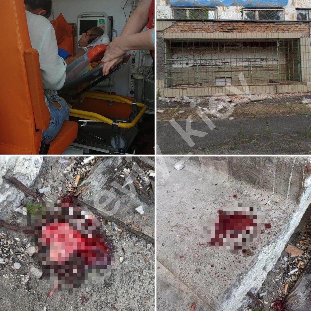 В Киеве аварийная плитка разбила голову парню