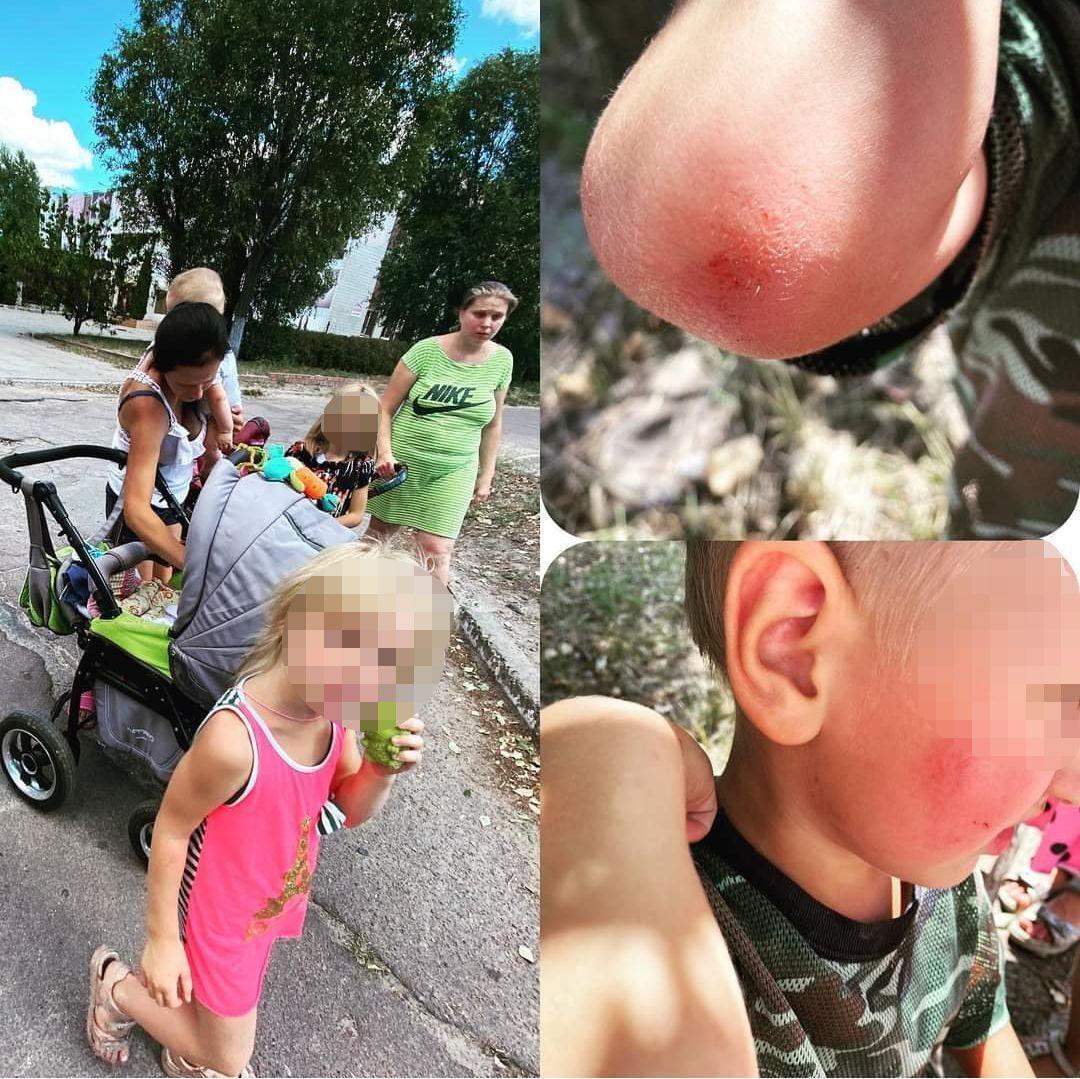На Днепропетровщине мать ударила 2-летнего ребенка головой об асфальт