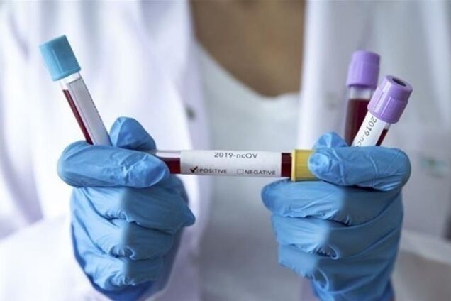 На Буковині зафіксували майже тисячу випадків коронавірусу