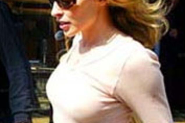 Кайли Миноуг лысеет из-за рака