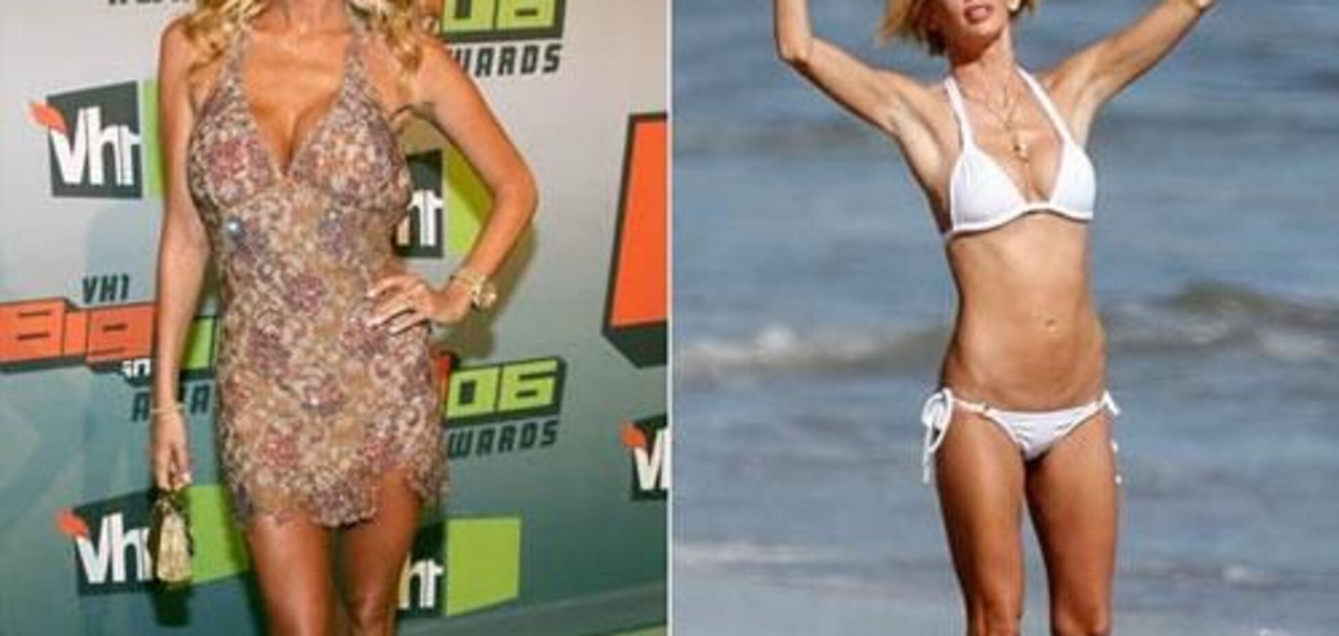 Звезды Голливуда,гонясь за красотой,становятся уродами. ФОТО