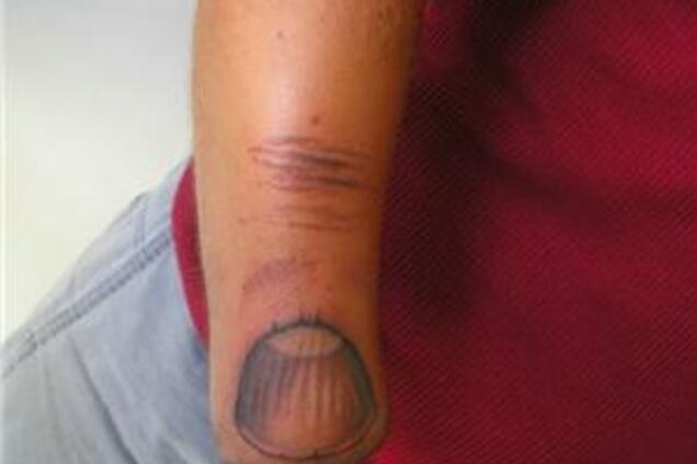 Ні руки? Так буде ніготь! Шокуюче ФОТО