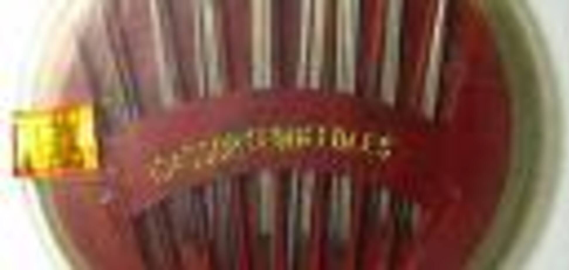 Месть родителей. В теле китаянки обнаружили 26 игл. ФОТО