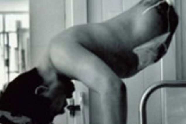 Китаец, разрезанный пополам 13 лет назад, учится ходить