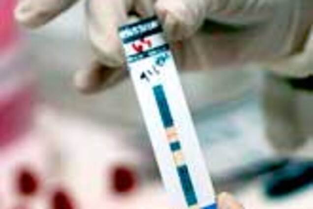 Кримських студентів безоплатно протестують на ВІЛ