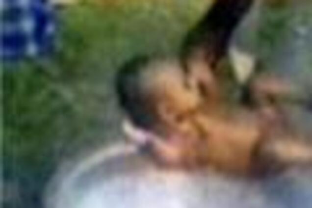 В Индии малышку искупали в кипятке