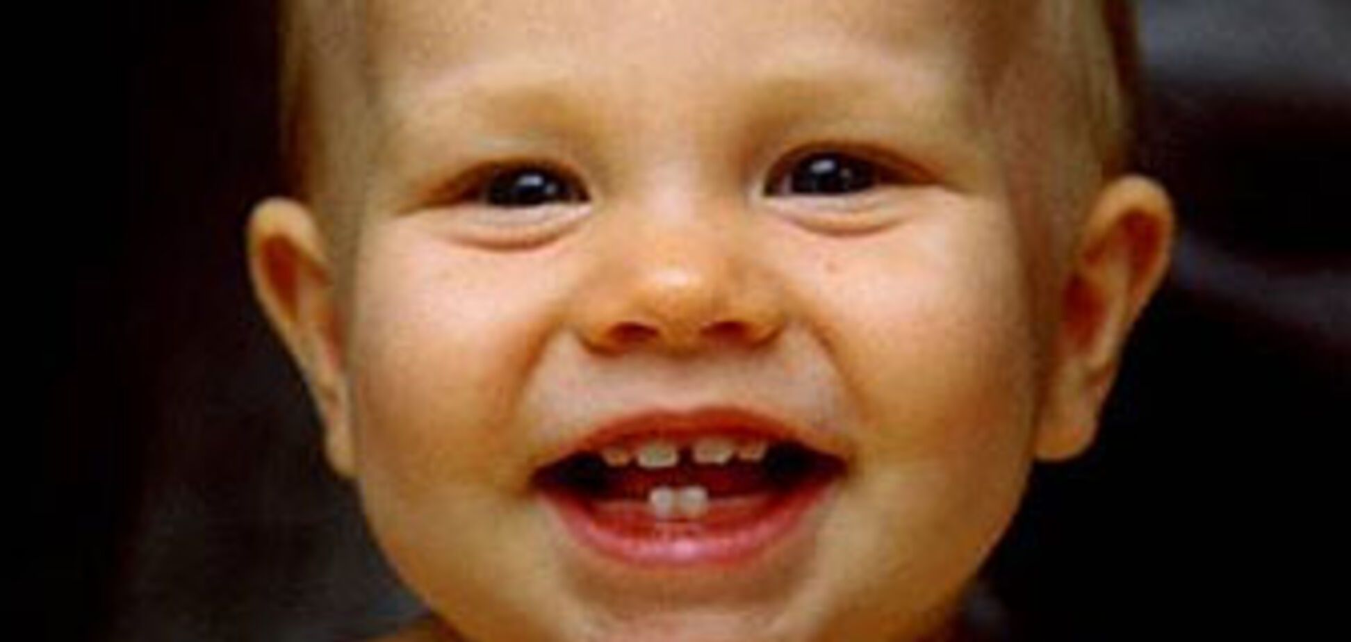 Детские зубки нуждаются в особой защите