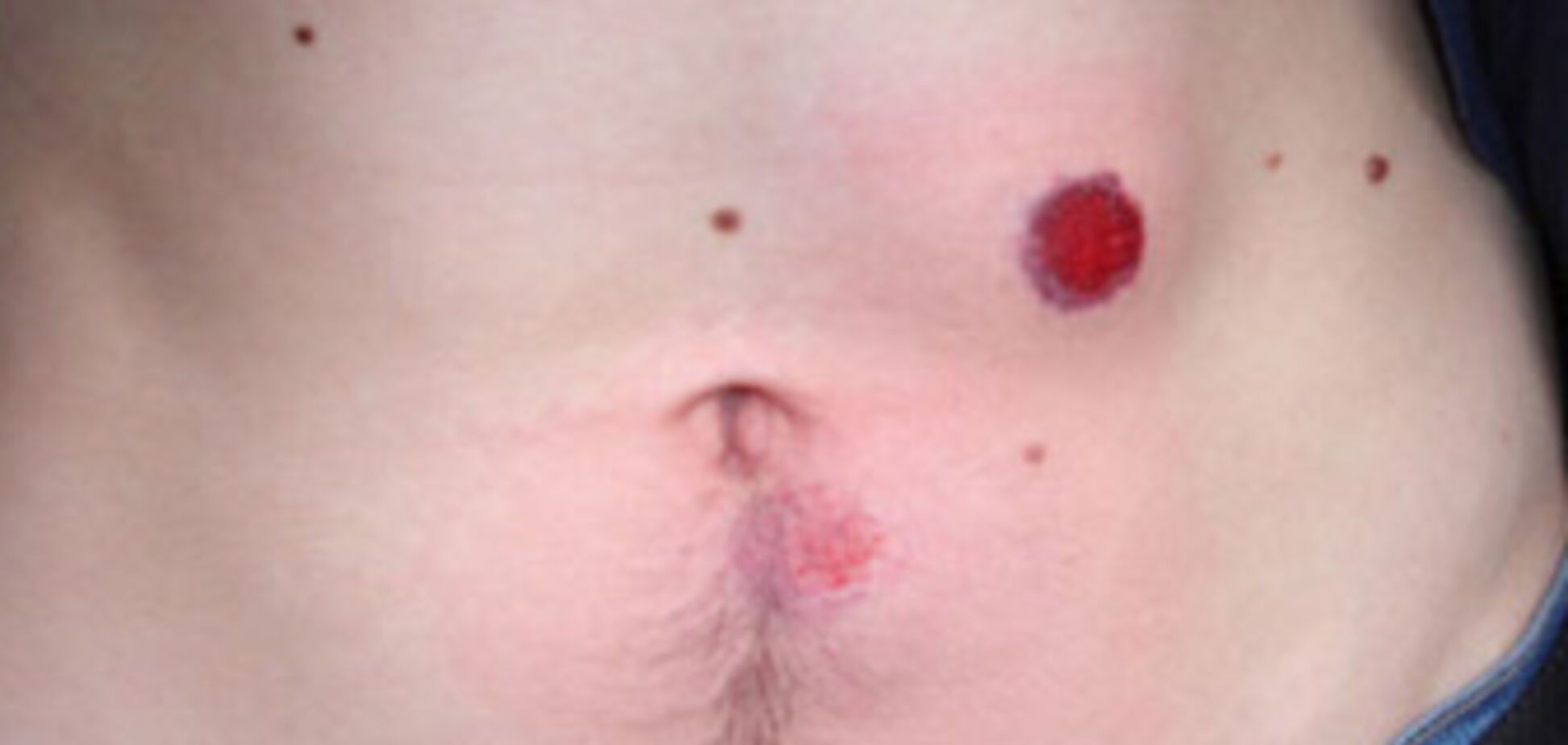 Депутат під час сварки поранив свого партнера по бізнесу