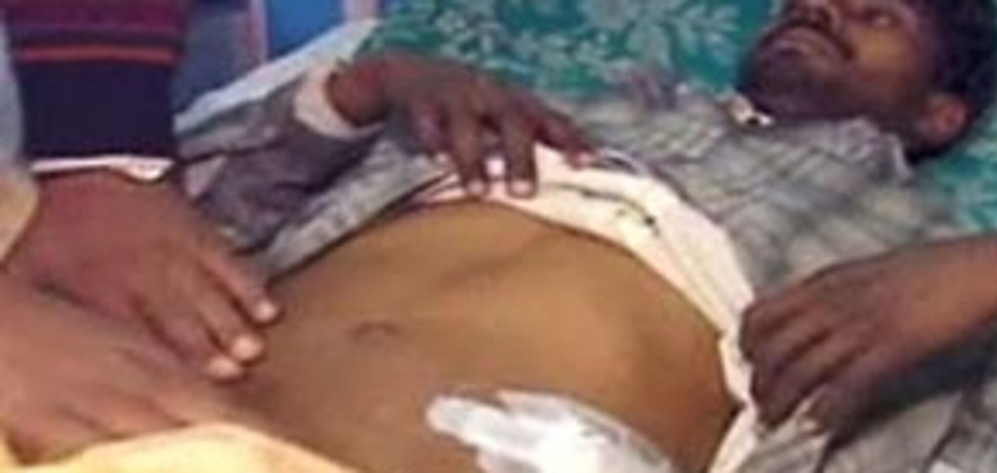 Банда 'Доктора Жах' насильно вирізала більше 500 нирок