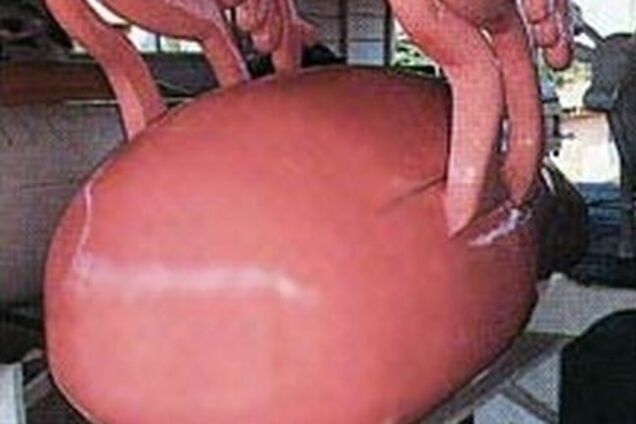 Каково это - родиться и умереть прямо в матке? Наглядно...