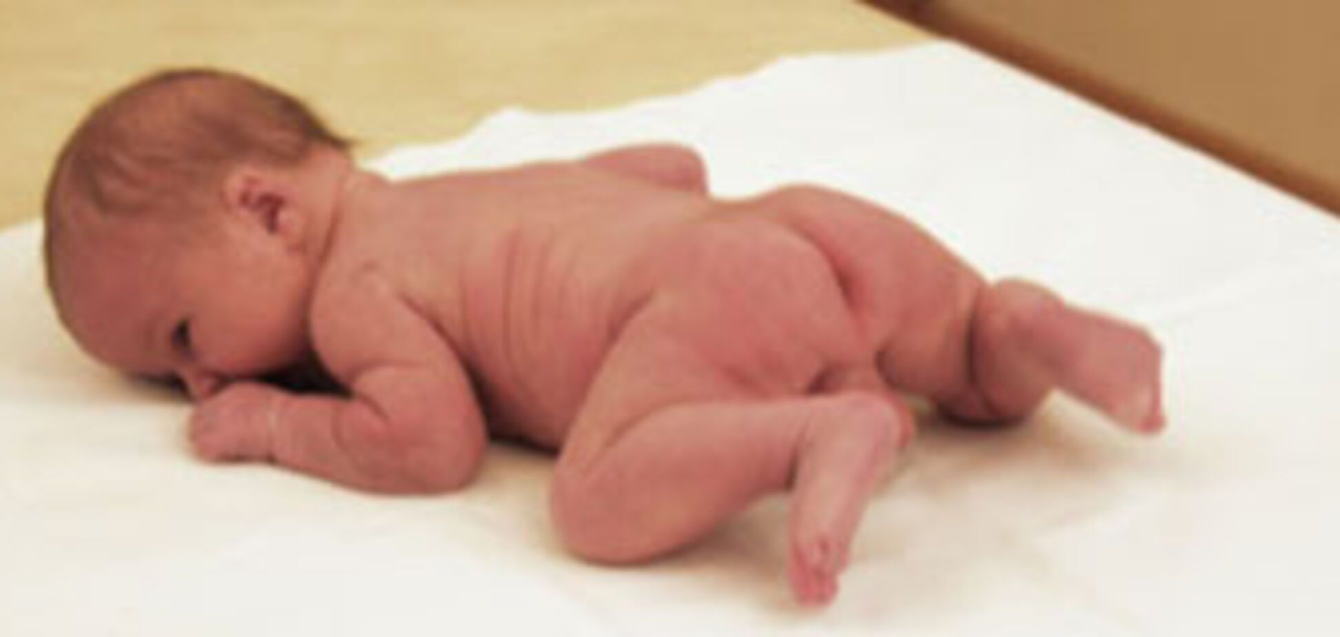 В Украине растет рождаемость, но мертворожденных