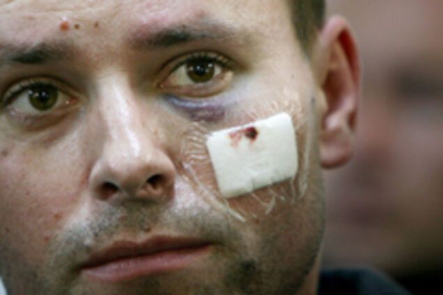 Українські миротворці не дотягли дев'ять днів ...