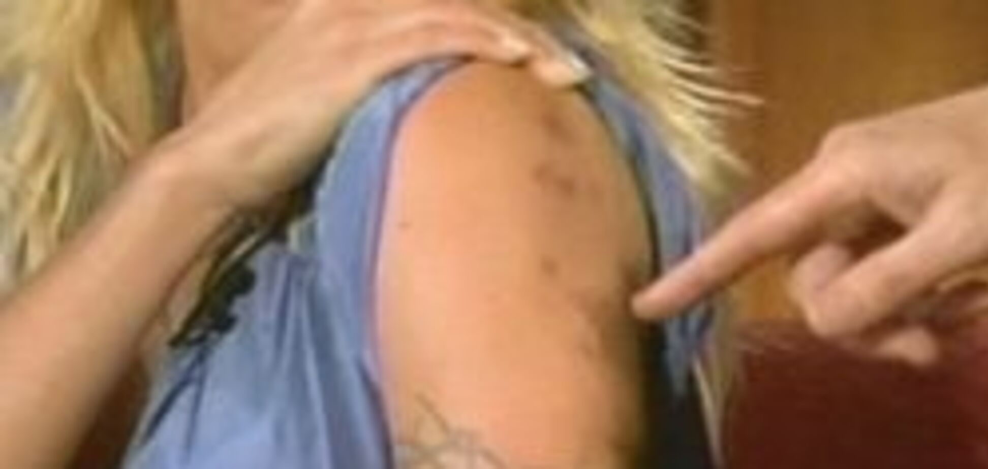 Ви ніколи не помічали темних плям на руці Памели Андерсон?