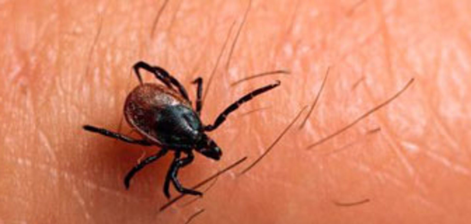 Клещи открыли охоту на украинцев