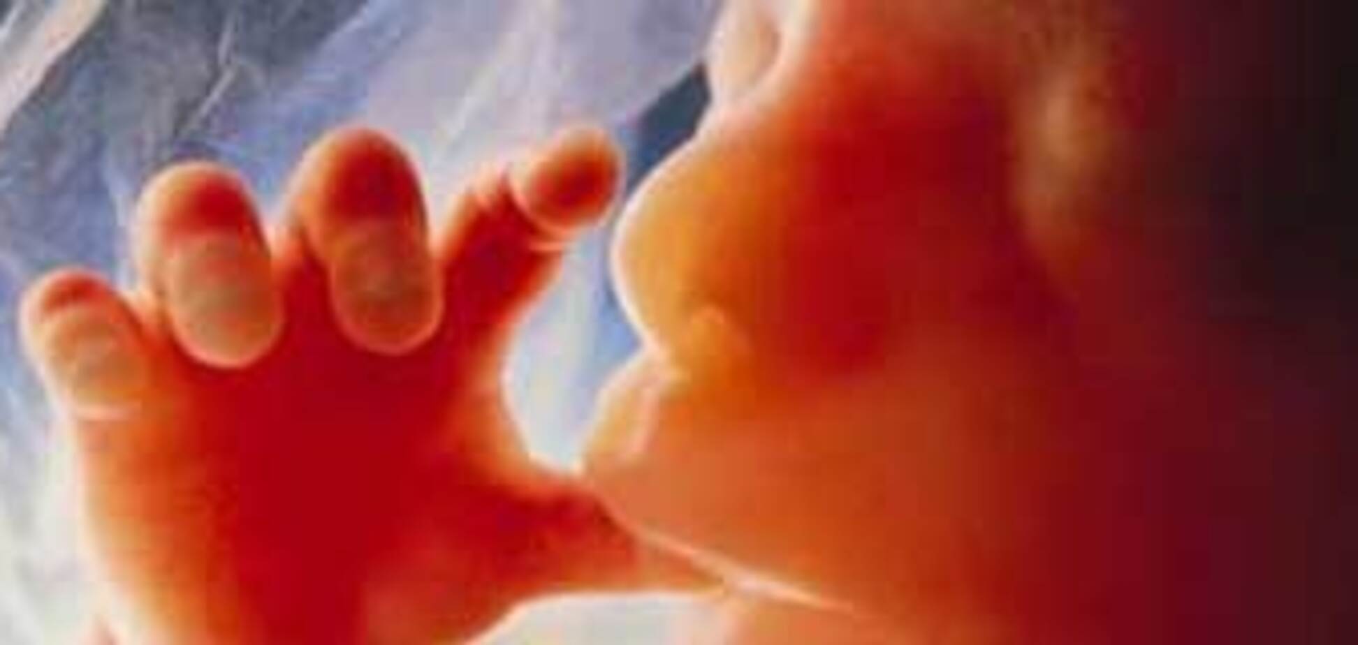 По количеству абортов Украина занимает первое место