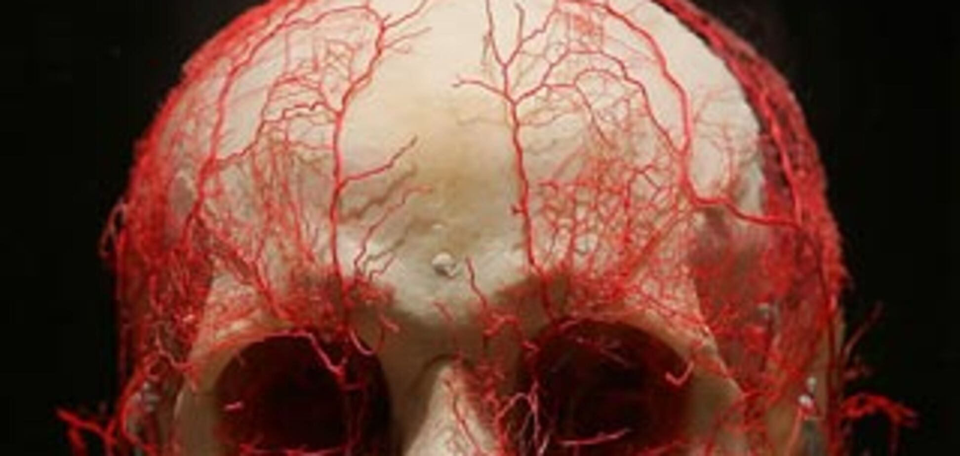 На выставке трупов были трупы замученных заключенных