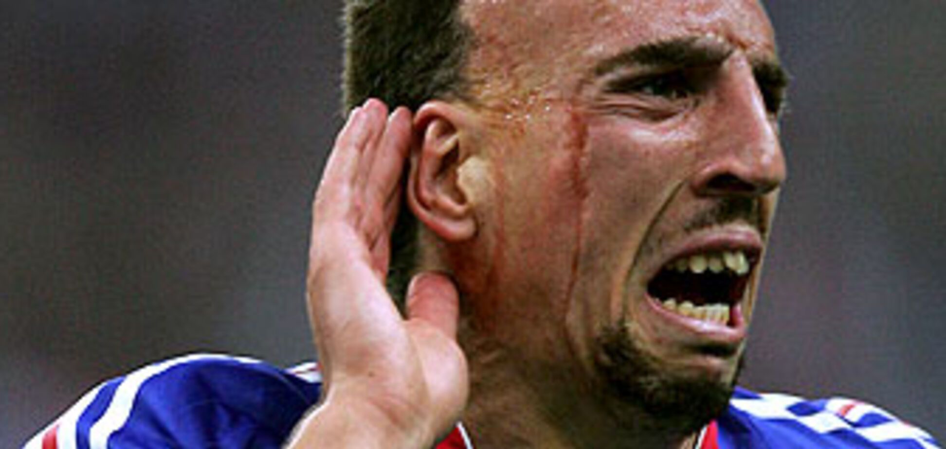 Рейтинг самых некрасивых футболистов на Евро-2008