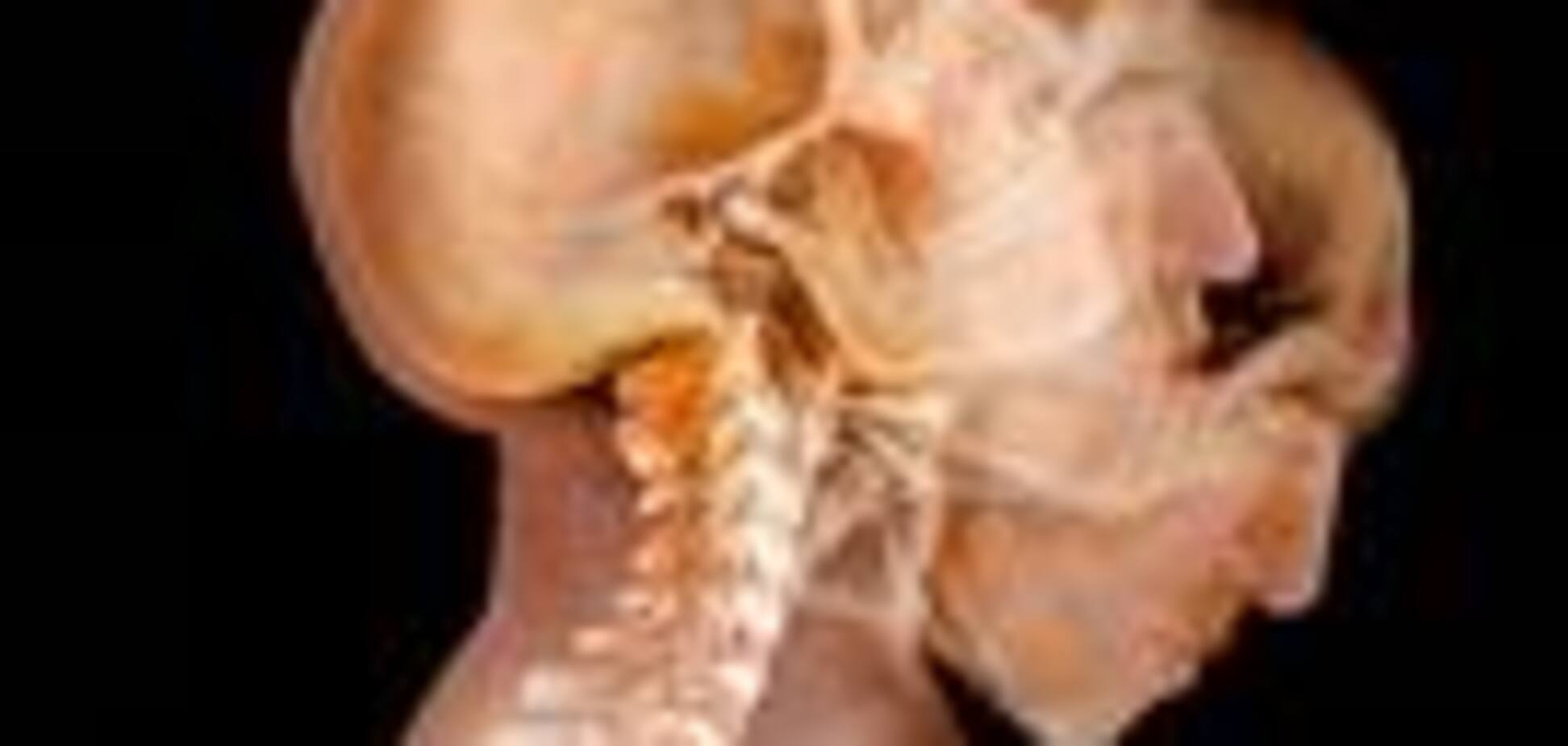 Смітник в тілі. Чи не пхайте в себе нікуди і нічого!