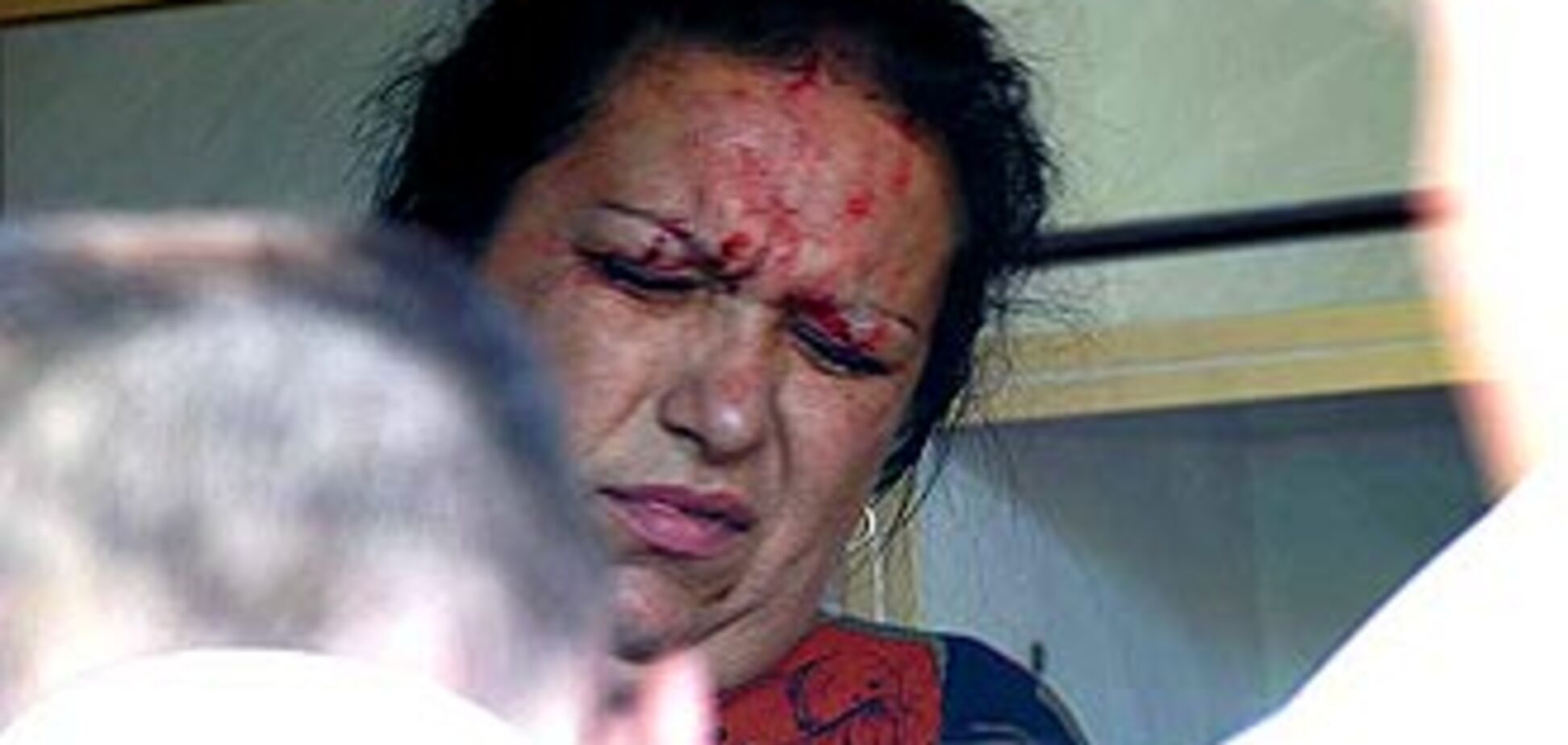 Крупное ДТП в Киеве возле бизнес-центра 'Парус'