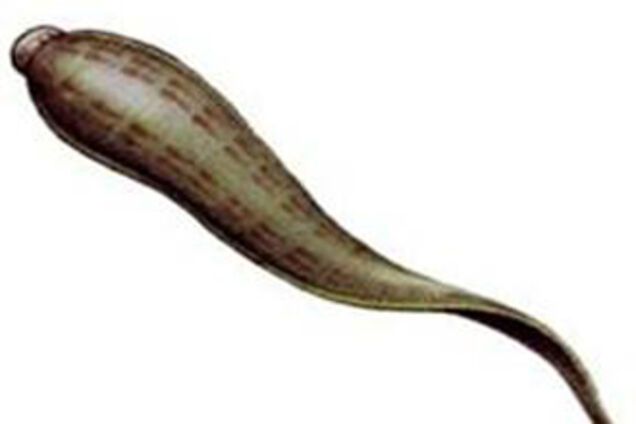Найти грабителя помогла... пиявка