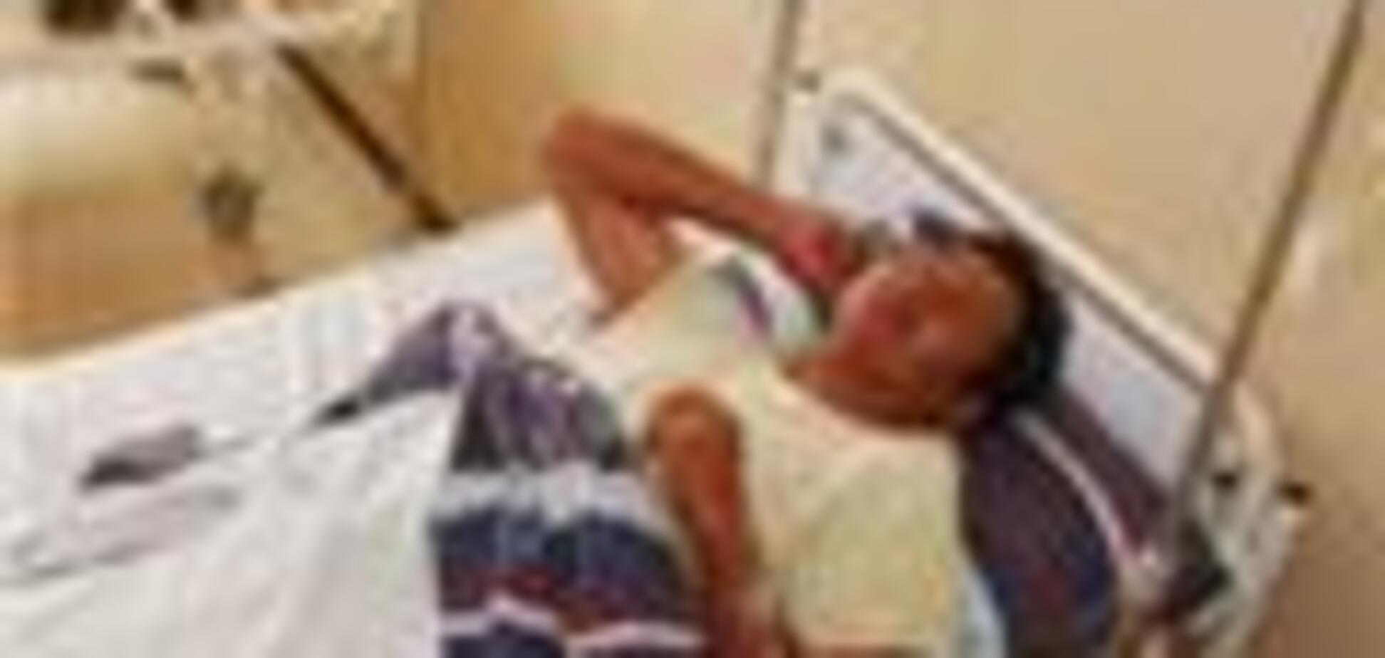 У Болівії лютує епідемія лихоманки денге, 19 жертв