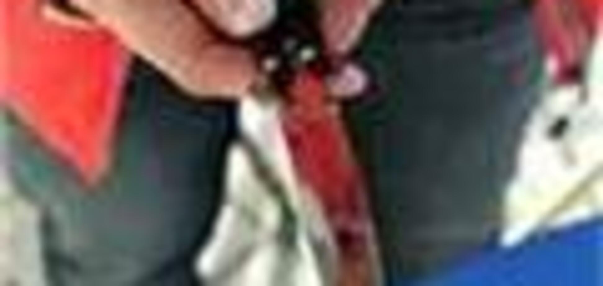 Грабіжник позбувся носа через п'яти тисяч