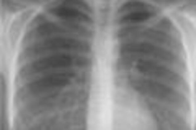 Українських машиністів жорстоко опромінили на словацькому кордоні