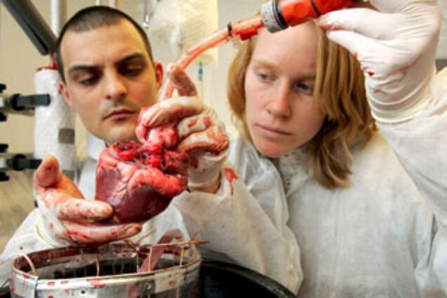 Кризис устроил мировую распродажу органов