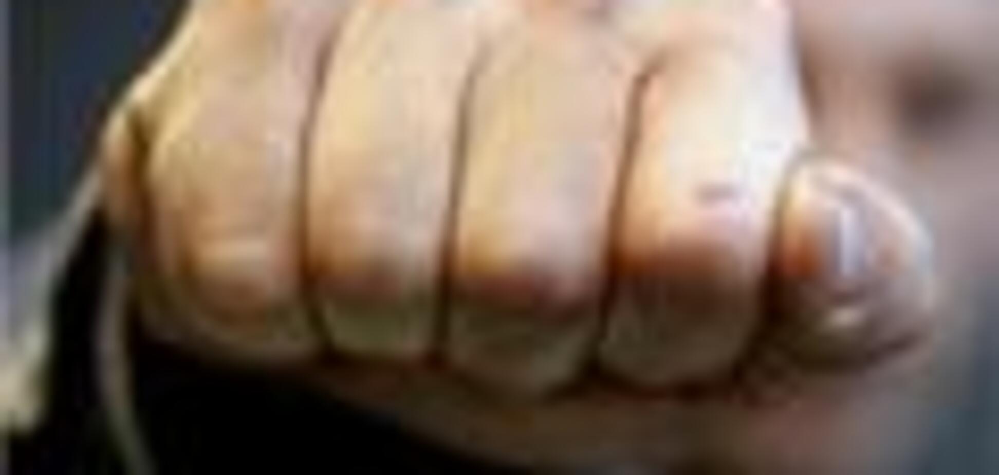 Избит редактор издательского дома