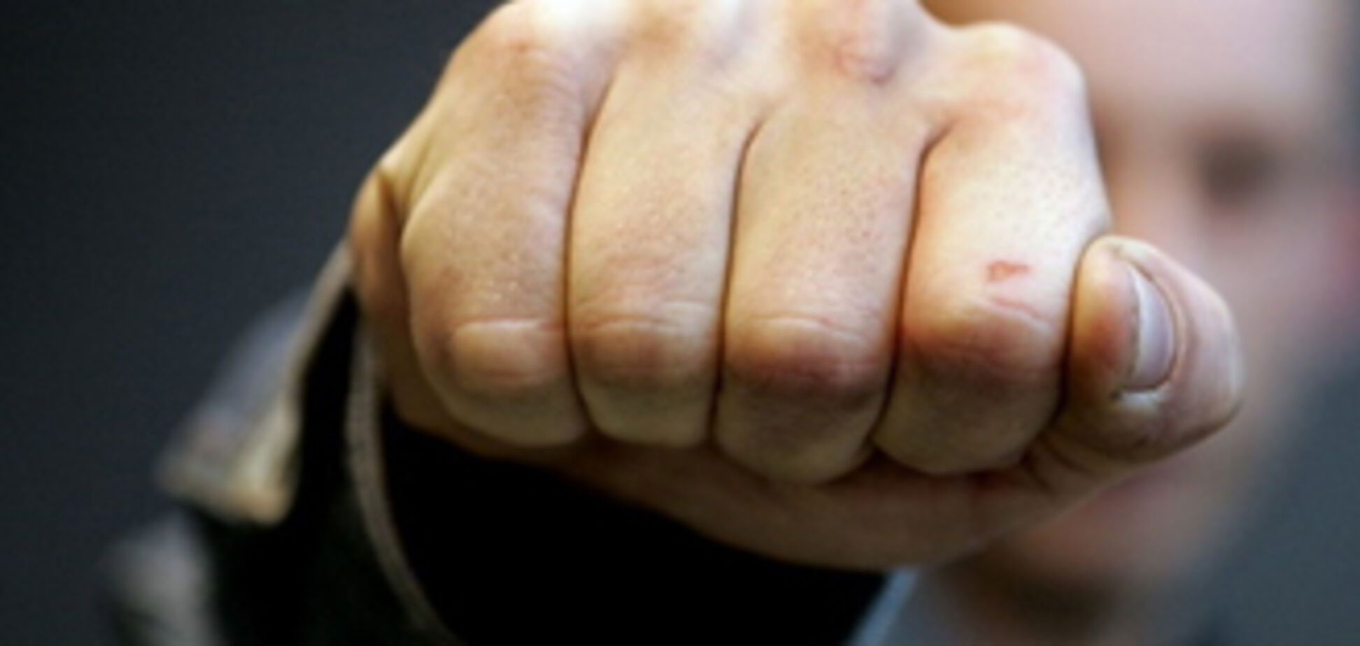 Директора «АрселорМиттал Кривой Рог» жестоко избили