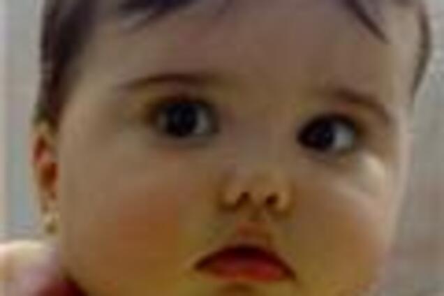 Помогите Настеньке, ребенку с синдромом Казабаха-Меррита