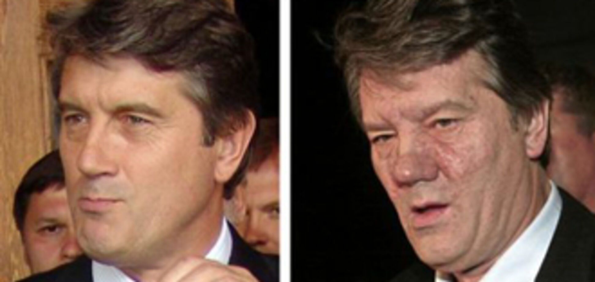 Отравление Ющенко превращается в мыльную оперу