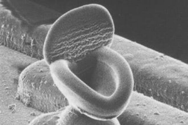 Спасатели МЧС доставали избирательницу из унитаза