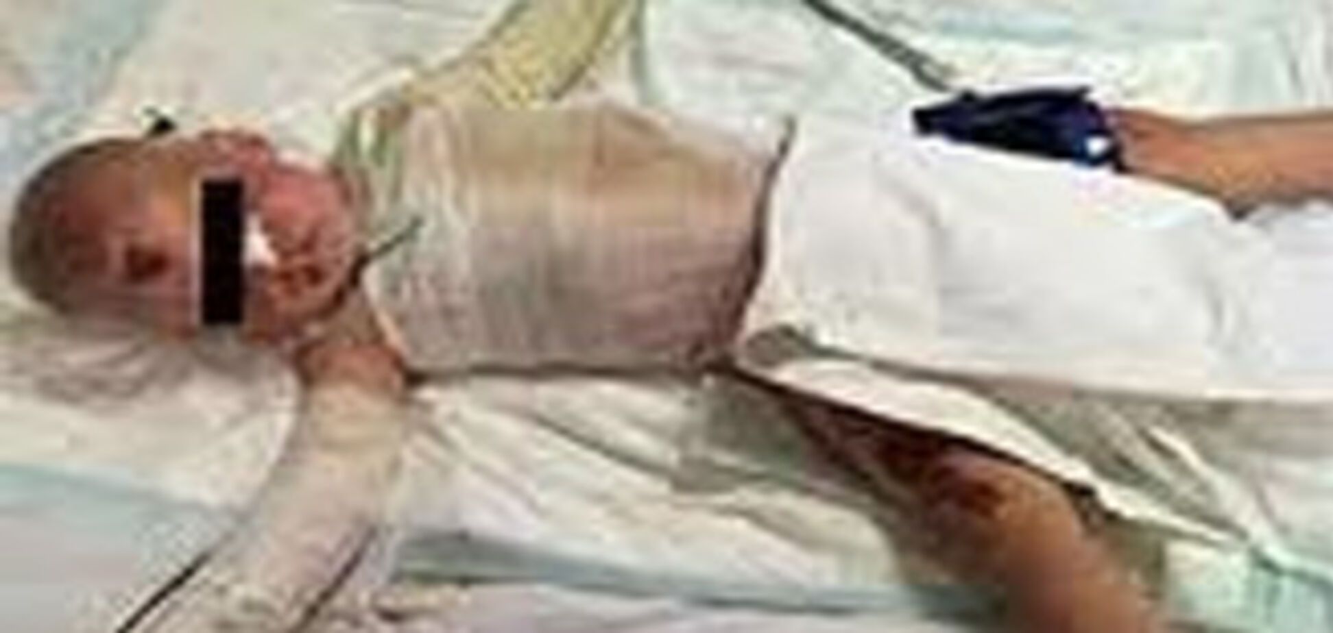 Вітчима, який поливав окропом дитини, мати пробачила