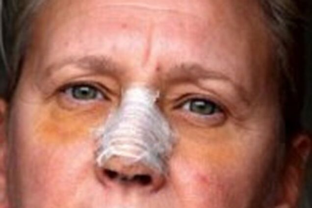 Парикхмахер позбулася носа через волосся