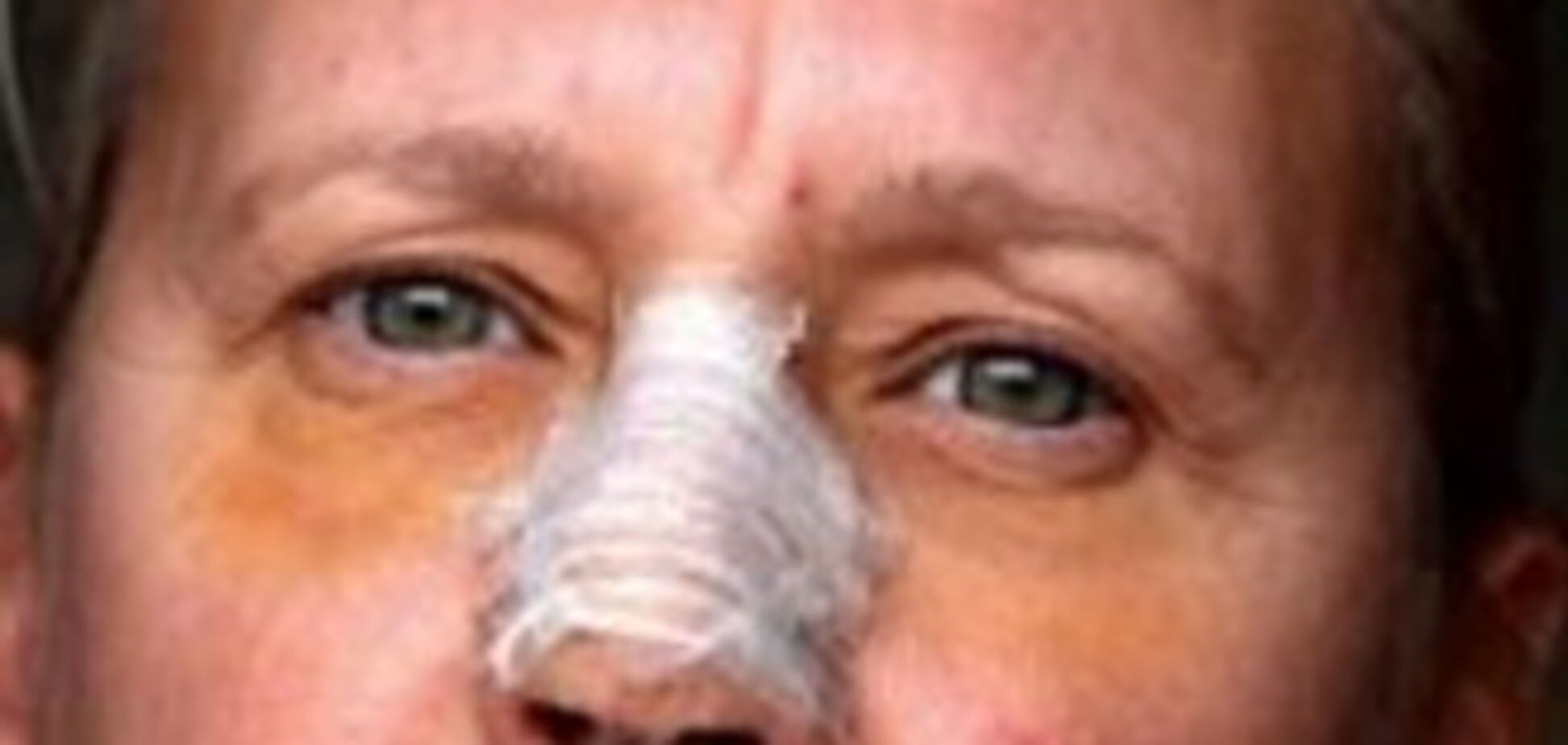 Парикхмахер позбулася носа через волосся