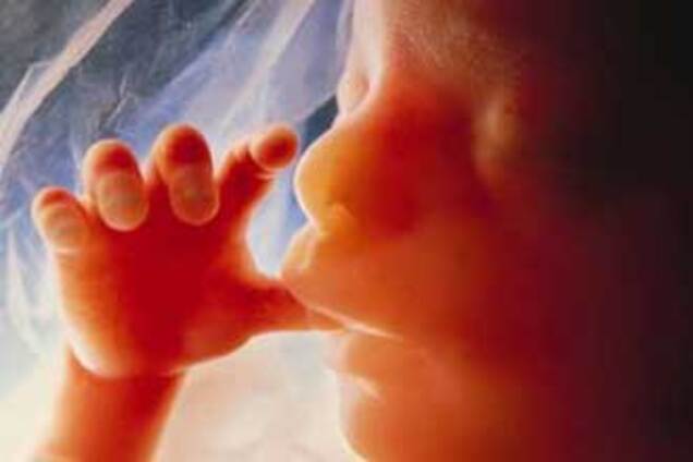 Американці вирішили каструвати всіх неблагополучних