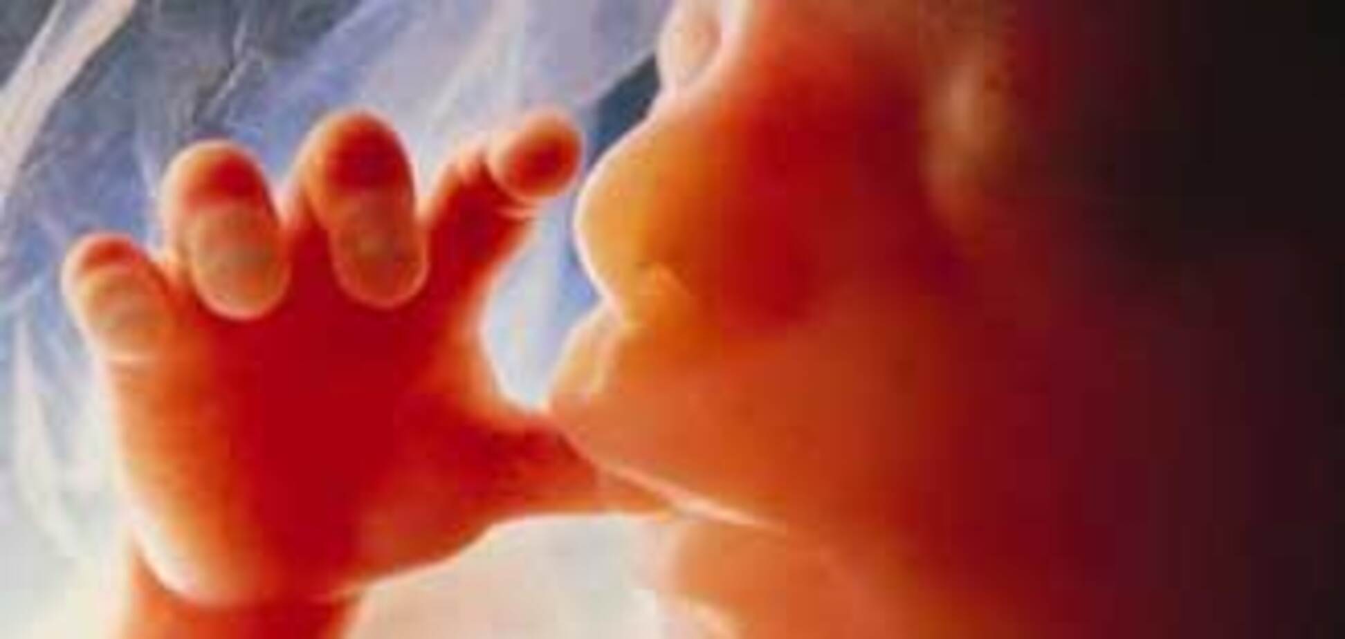 Американці вирішили каструвати всіх неблагополучних