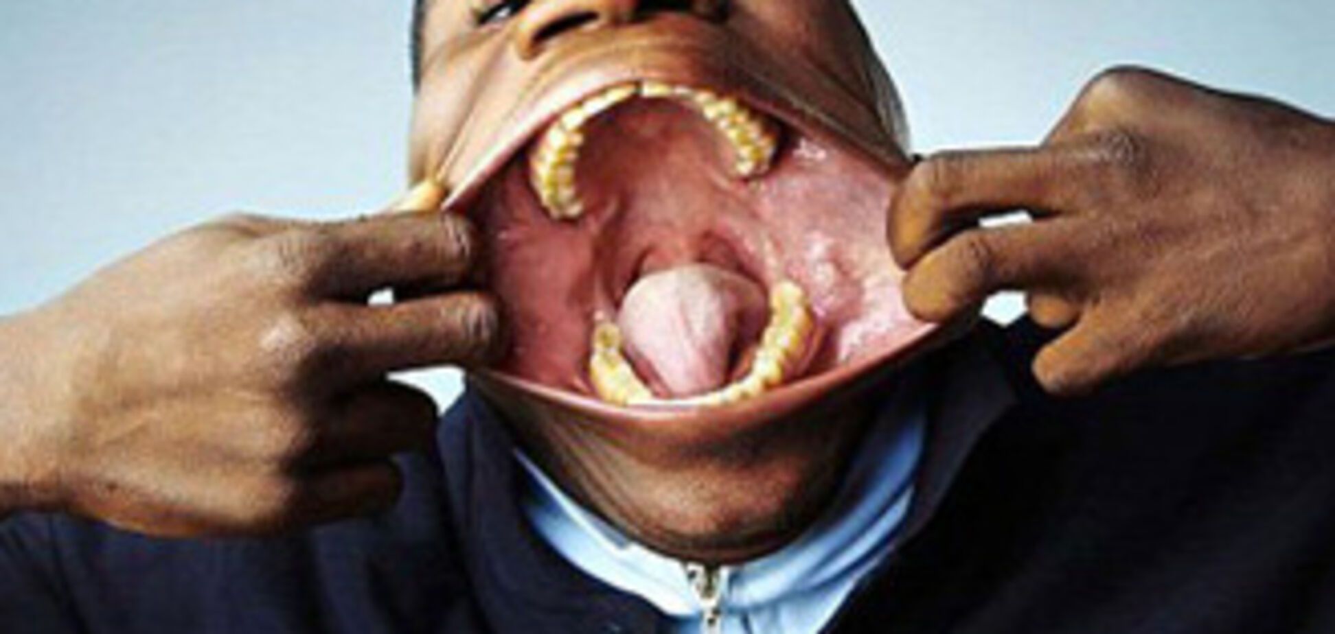 Самый большой рот в мире. ФОТО