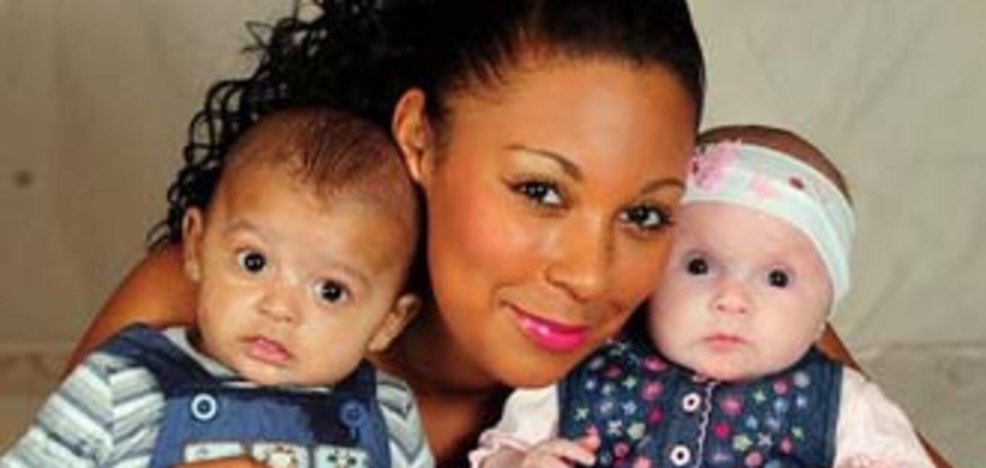 Женщина родила двойняшек с разным цветом кожи. ФОТО