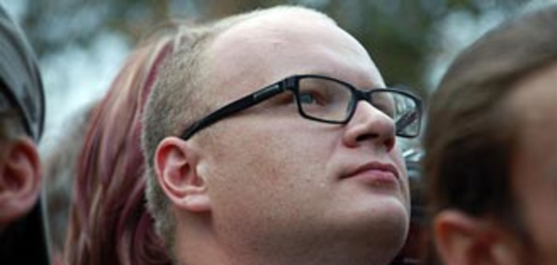 Искалеченный журналист Кашин требует отключить его от ИВЛ