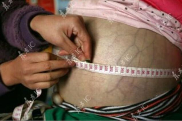 В Китае найдена 4-летняя 'беременная' девочка. ФОТО