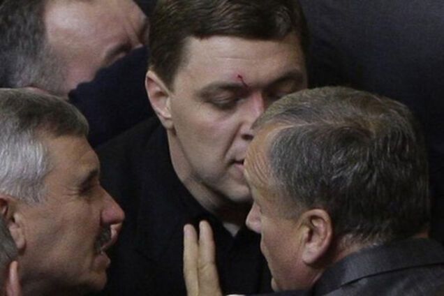 Глава Минфина разбил Налоговым кодексом лицо бютовца