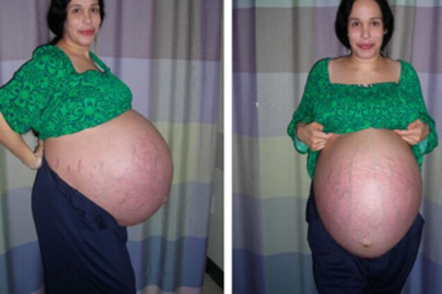 Мать 'восьмерняшек' подозревают в меркантильности