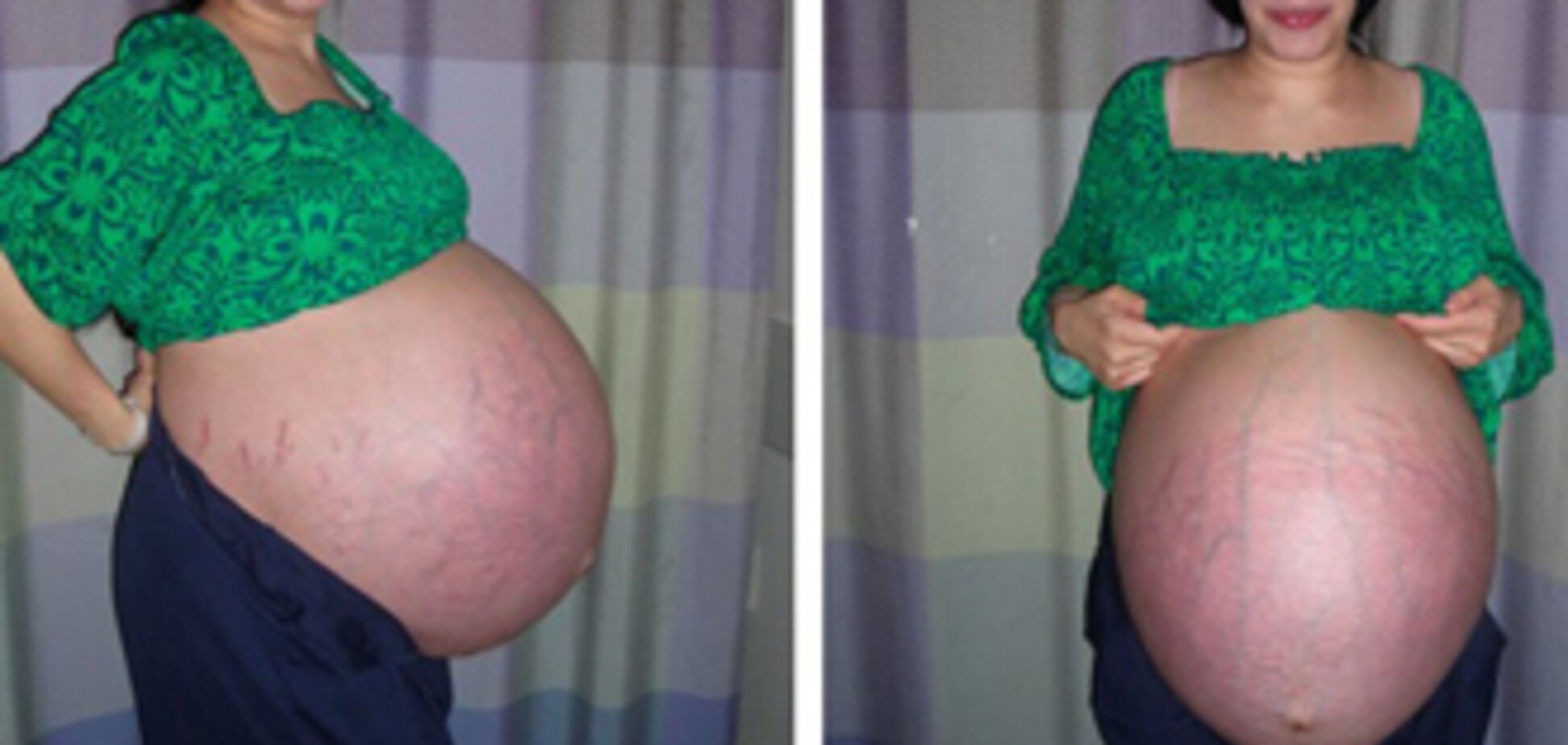 Мать 'восьмерняшек' подозревают в меркантильности