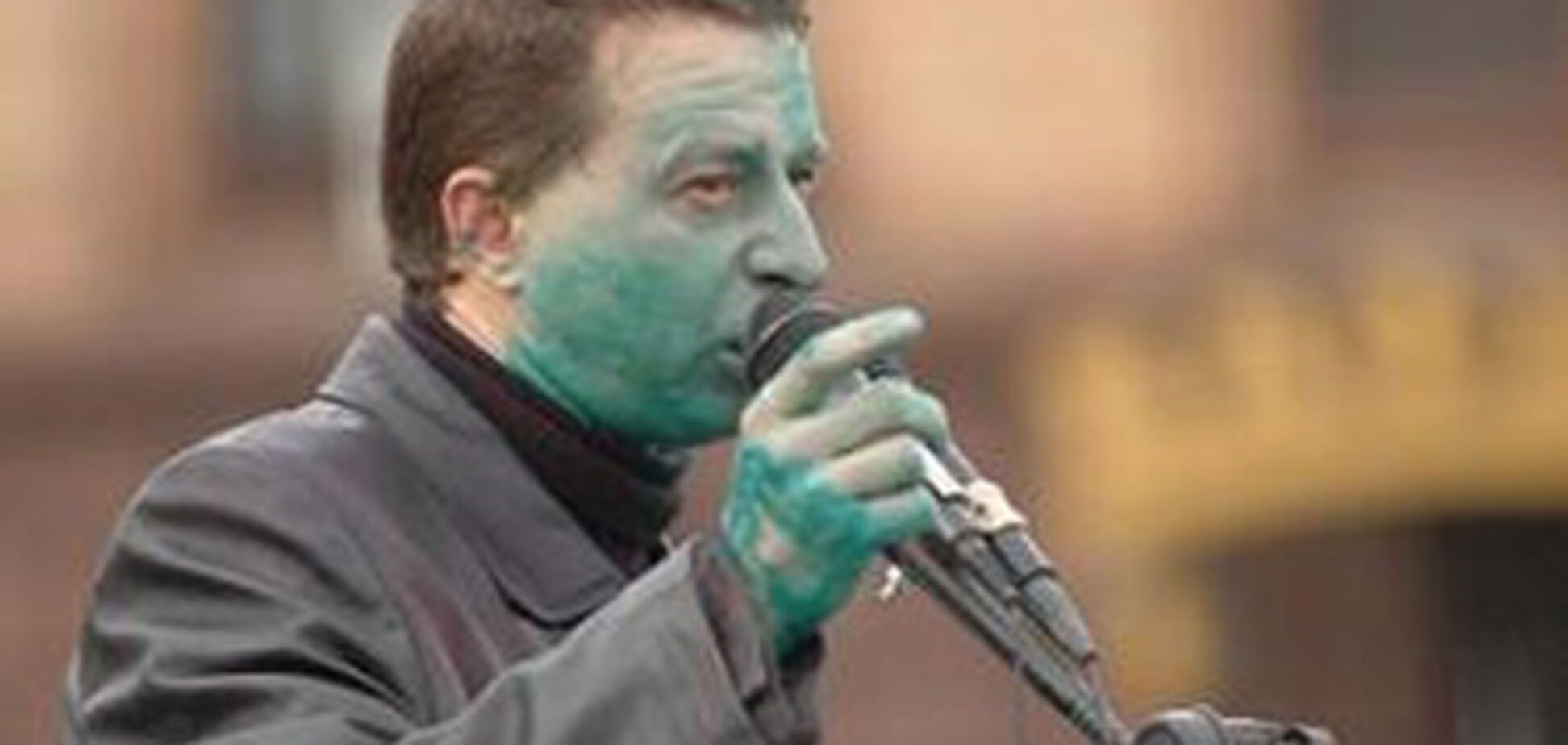 На 'Майдане' предпринимателя лишили зрения и облили зеленкой