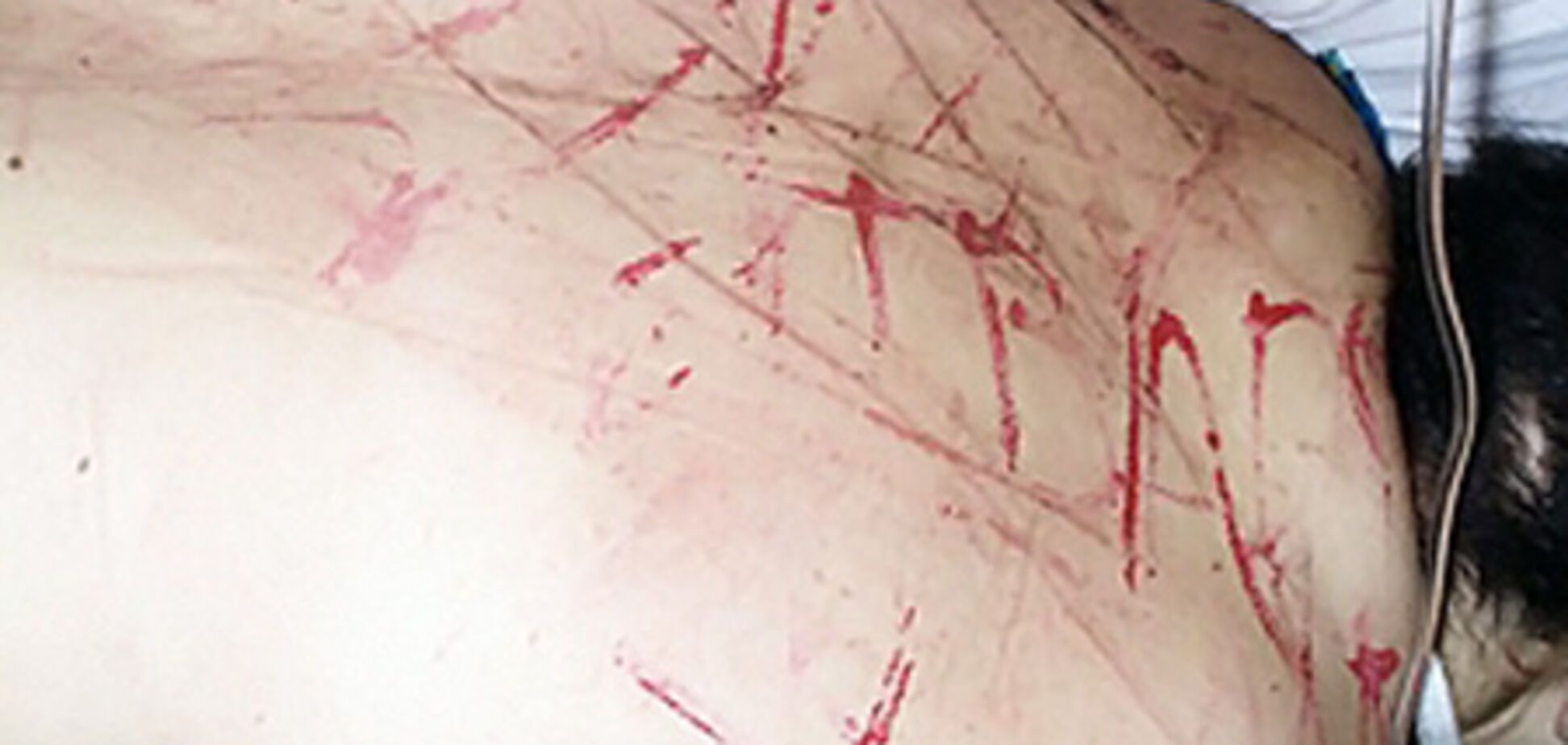 Жестокие пытки подруг довели девушку до суицида. ФОТО