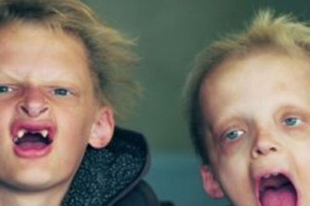 Братья-вампиры мечтают о зубах. ФОТО